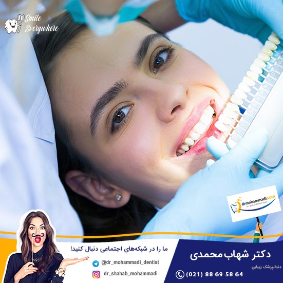 شش برند برتر کامپوزیت دندان کدامند؟ - کلینیک دندانپزشکی دکتر شهاب محمدی